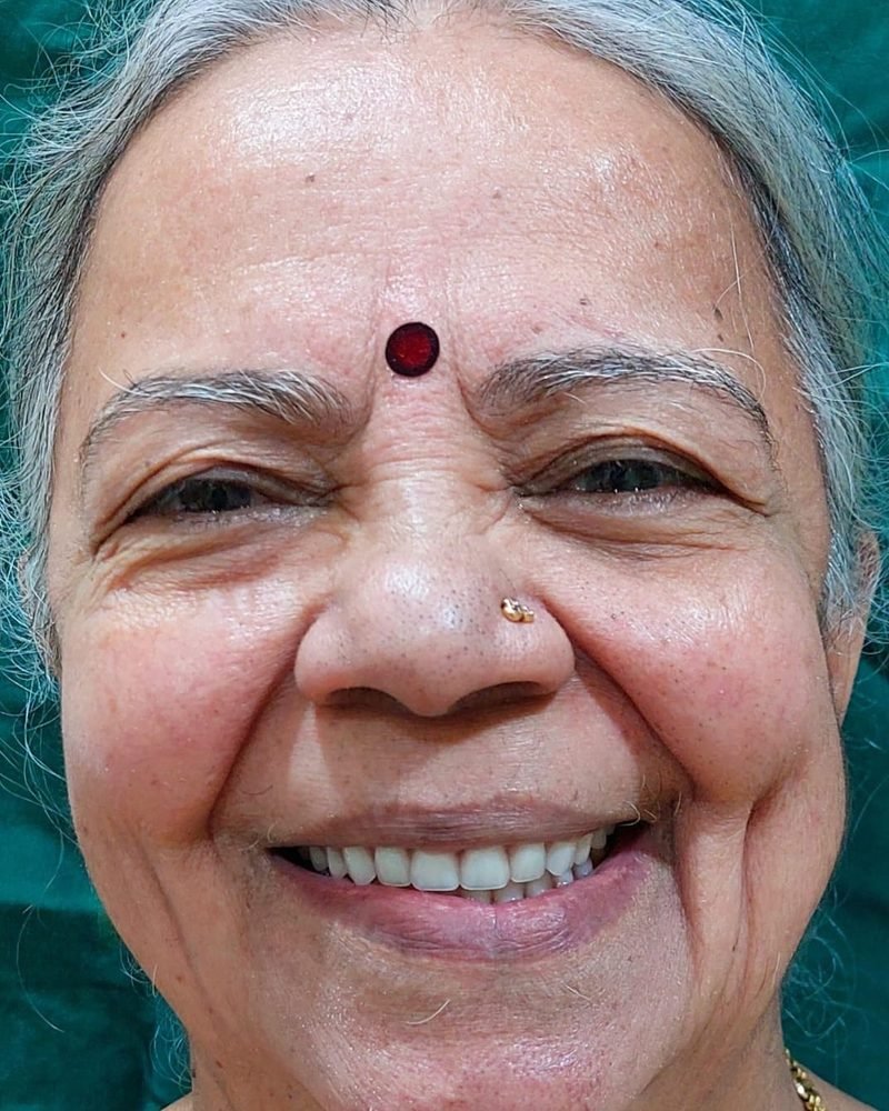 After treatment at Jayanagar Dental Clinic