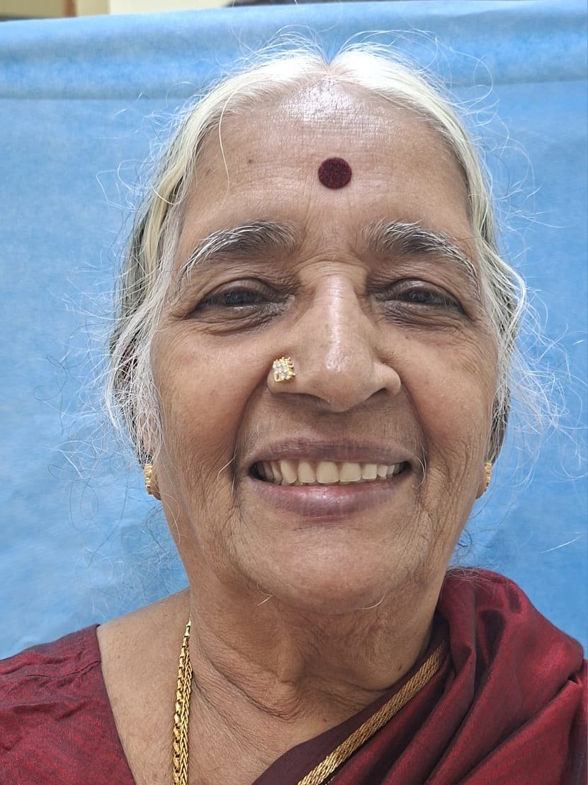 Complete Denture Prosthesis &mdash; after treatment at Jayanagar Dental Clinic