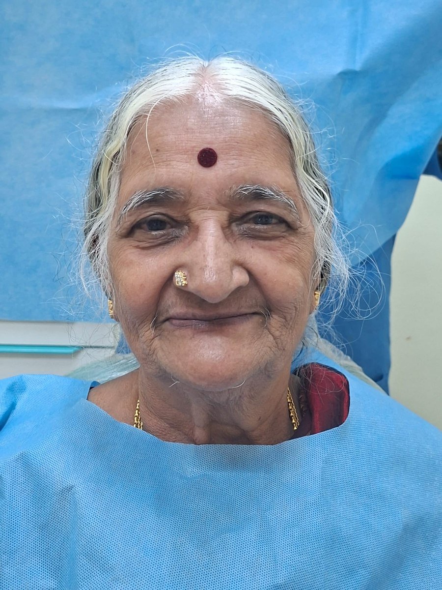 Complete Denture Prosthesis &mdash; before treatment at Jayanagar Dental Clinic