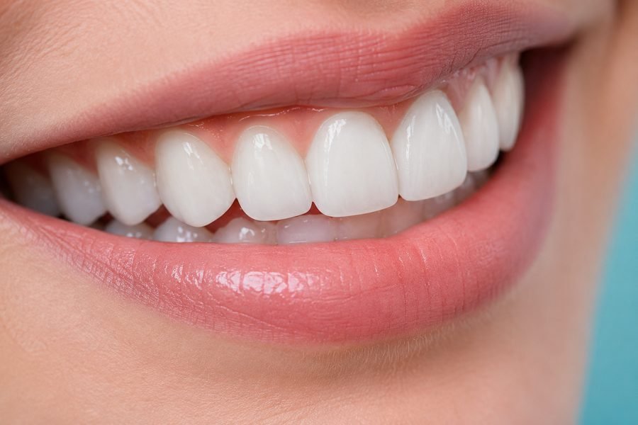 Smile Makeovers