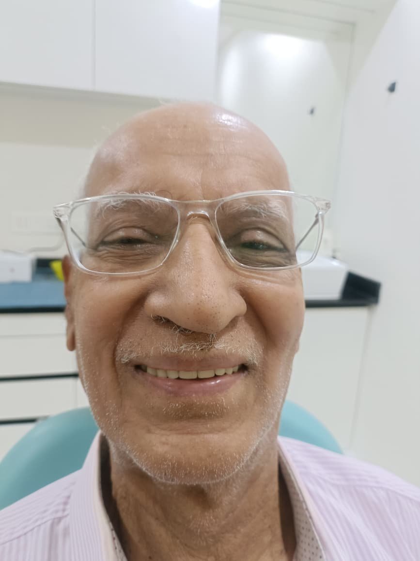 Complete Denture Rehabilitation &mdash; after treatment at Jayanagar Dental Clinic